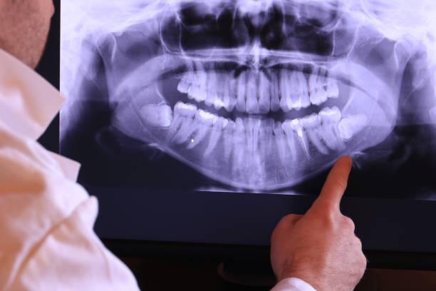 Best Emergency TMJ Treatment in Coushatta, LA