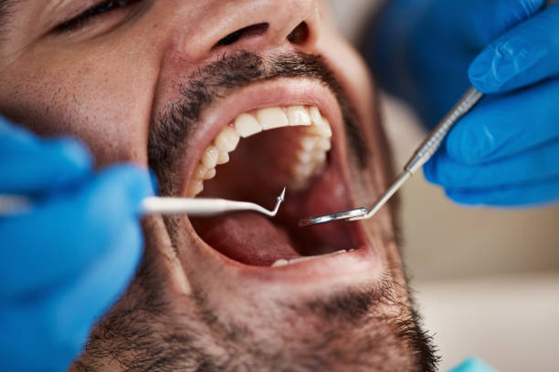 Best Urgent Care for Lost Fillings or Crowns in Coushatta, LA